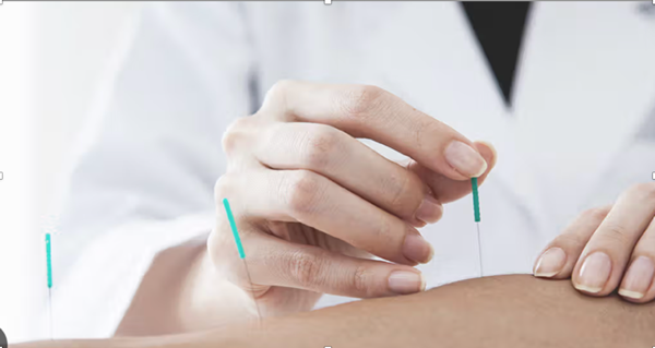 Functional Dry Needling